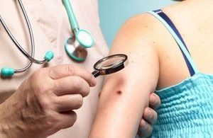 Cilt Kanseri Nedir? Nedenleri, Çeşitleri, Tanı ve Tedavisi